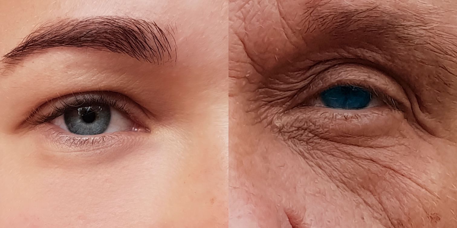 Why Does the Skin Age?